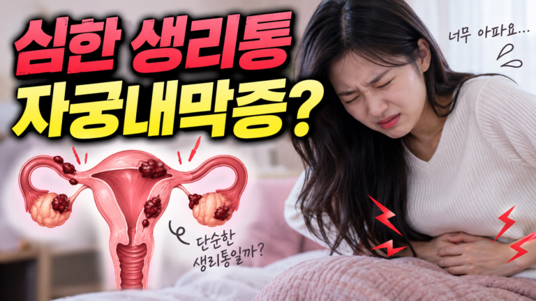 심한 생리통 자궁내막증?