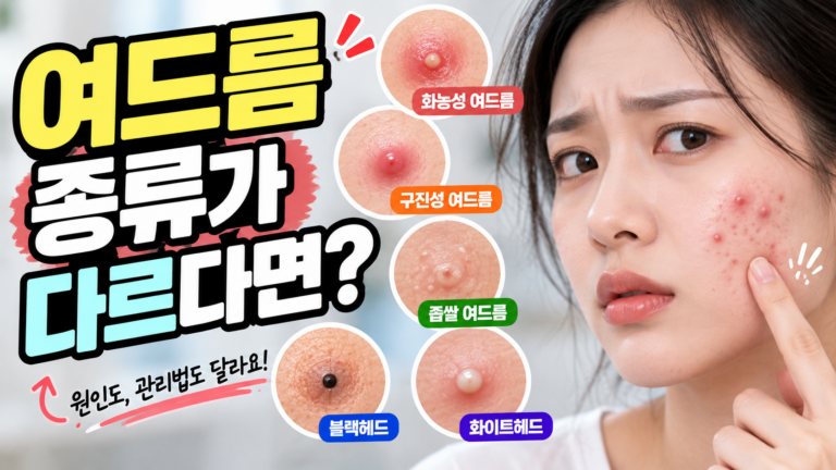 여드름 염증성·비염증성 차이는? 3 여드름 염증성·비염증성 차이는?
