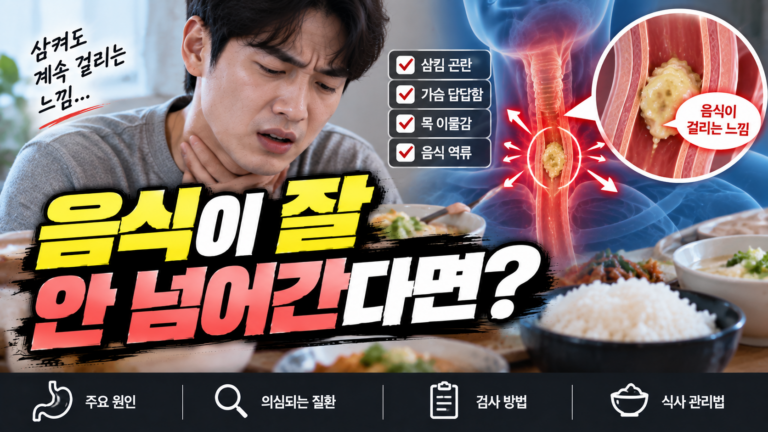 식도이완불능증 음식과 물을 삼키기 힘든 이유 4 식도이완불능증 음식과 물을 삼키기 힘든 이유