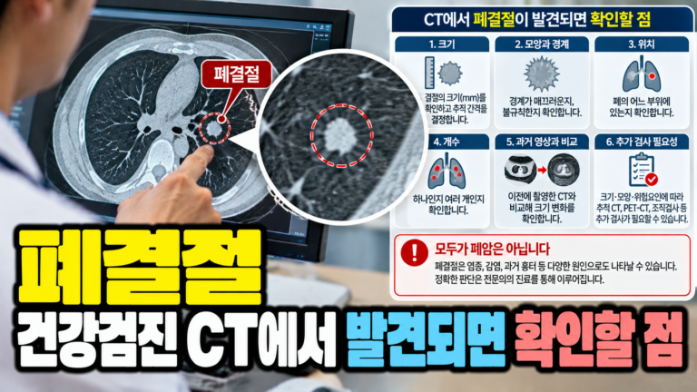 폐결절 건강검진 CT에서 발견되면 확인할 점 3 폐결절 건강검진 CT에서 발견되면 확인할 점