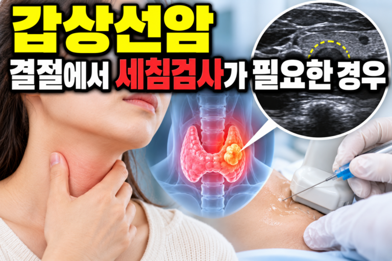 갑상선암 결절에서 세침검사가 필요한 경우 2 갑상선암 결절에서 세침검사가 필요한 경우