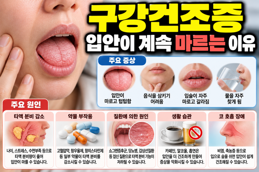 구강건조증 입안이 계속 마르는 이유 1 구강건조증 입안이 계속 마르는 이유