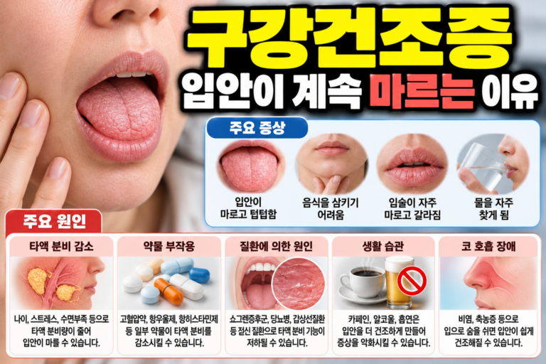 구강건조증 입안이 계속 마르는 이유