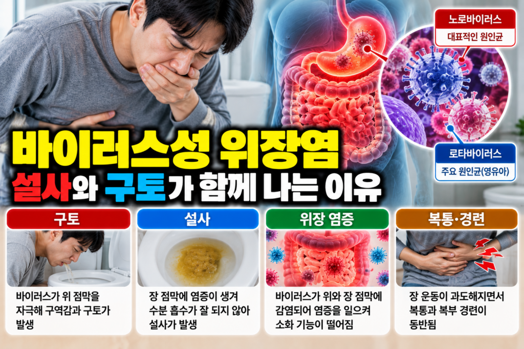 바이러스성 위장염 설사와 구토가 함께 나는 이유
