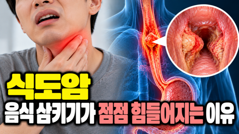 식도암 음식 삼키기가 점점 힘들어지는 이유