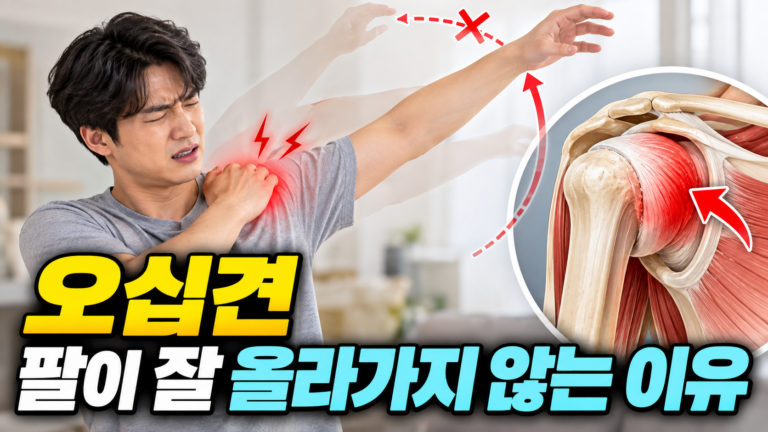 오십견 팔이 잘 올라가지 않는 이유 11 오십견 팔이 잘 올라가지 않는 이유