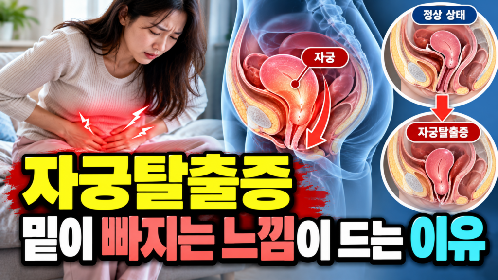 자궁탈출증 밑이 빠지는 느낌이 드는 이유
