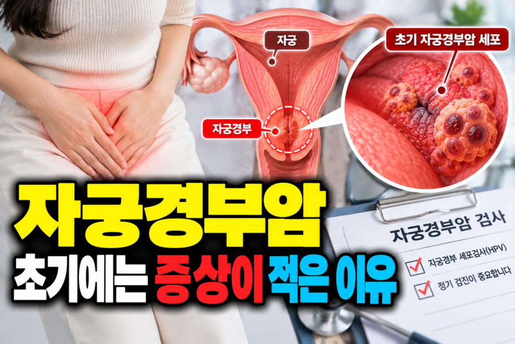 자궁경부암 초기에는 증상이 적은 이유 1 자궁경부암 초기에는 증상이 적은 이유