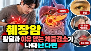 췌장암 황달과 이유 없는 체중감소가 나타난다면